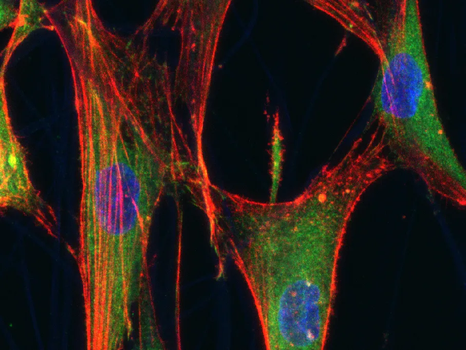 hMSCs on scaffolds