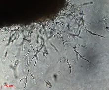 Dental image